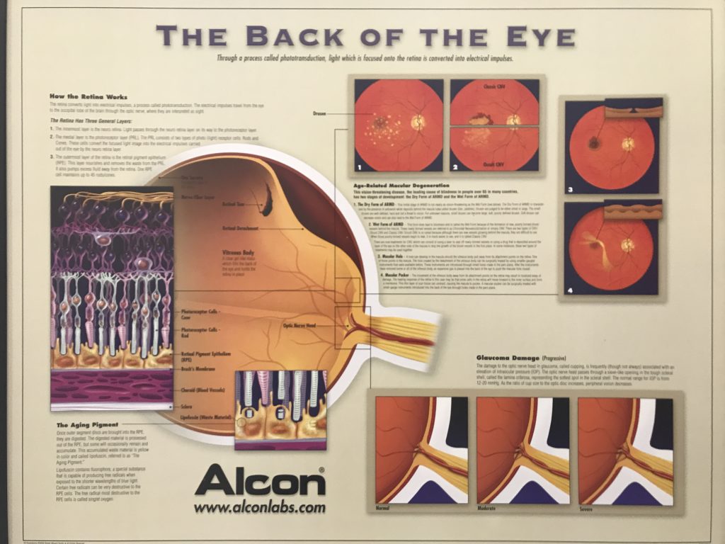 IMG 5263 1 1024x768 - | Eye & Glasses Optometrist | Your Trusted Eye Care Professional. When was your last time you did your eye check up?